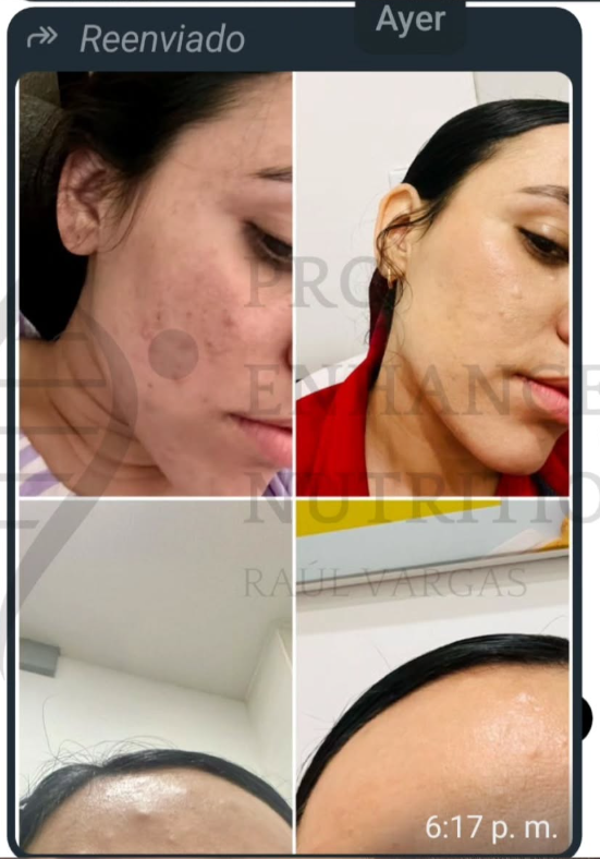 Testimonio PRO EHN 28